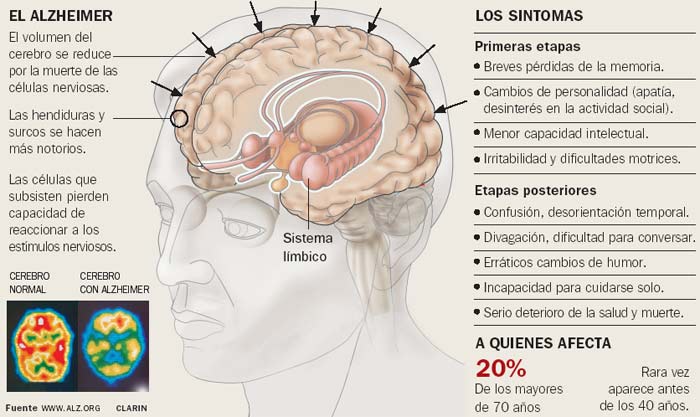 deteccion_precoz_alzheimer[1]