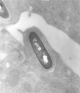Listeria monocytogenes 