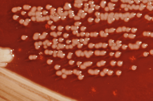 Yersinia enterocolitica