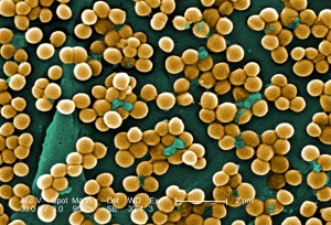 Staphyloccocus aureus