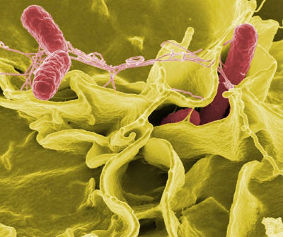 Microsc&ograve;pia electr&ograve;nica de Salmonella Typhimurium.