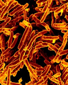 Mycobacterium tuberculosis Bacteria (NIH Flickr)